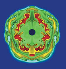 [6] �������� ��������� ������ ��������������� ������.